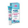 Acneclear Intensive Anti-Acne Treatment